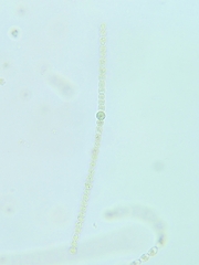 Anabaena