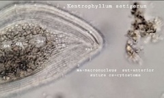 Kentrophyllum setigerum