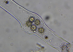 Heliozoa