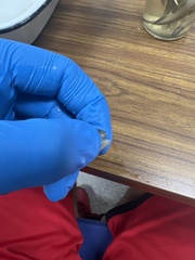 Luxilus chrysocephalus