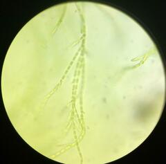 Stigeoclonium