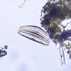Cymbella