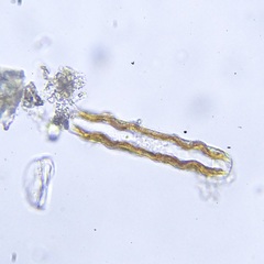 Surirella