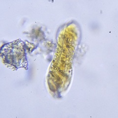 Surirella