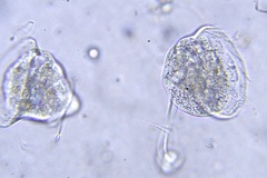 Vorticella campanula