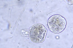 Vorticella campanula