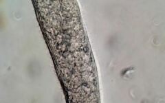 Helicoprorodon multinucleatum