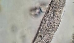 Helicoprorodon multinucleatum