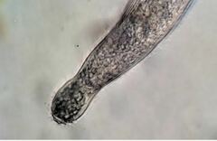 Helicoprorodon multinucleatum