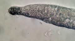 Helicoprorodon multinucleatum