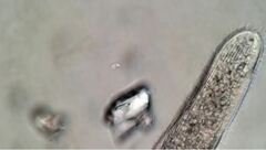 Helicoprorodon multinucleatum