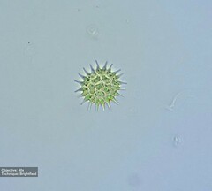 Pseudopediastrum boryanum longicorne