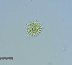 Pseudopediastrum boryanum longicorne