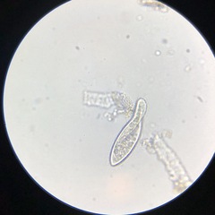 Paramecium