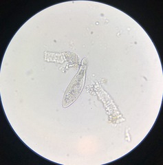 Paramecium