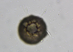 Amoebozoa