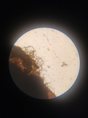 Trichia botrytis