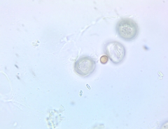 Byssocorticium pulchrum