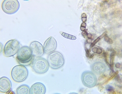 Byssocorticium pulchrum