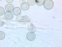 Byssocorticium pulchrum