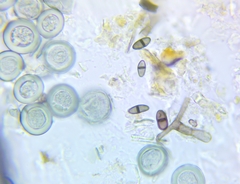 Byssocorticium pulchrum