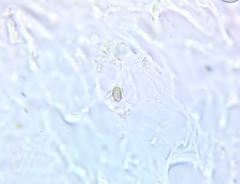 Byssocorticium pulchrum