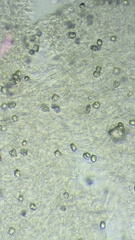 Clitocybe phyllophila