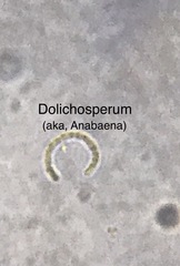 Dolichospermum