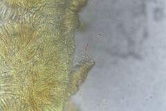 Orbilia crenatomarginata