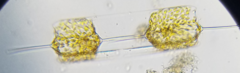 Ditylum