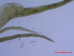 Trichodon cylindricus