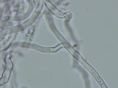 Peniophorella pubera