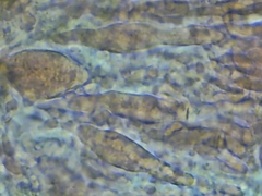 Peniophora incarnata