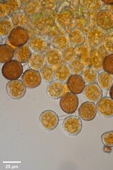 Puccinia hydrocotyles