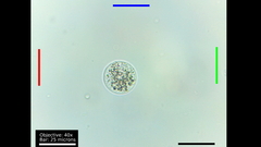 Amoebidae