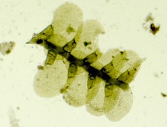 Cheilolejeunea clypeata