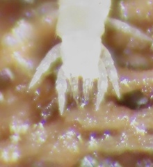 Symphyla