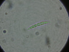 Haematomma persoonii