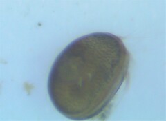 Ostracoda