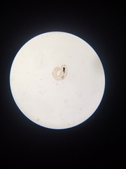 Amoebidae
