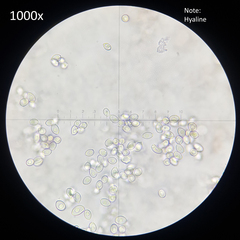 Leucocoprinus cretaceus