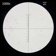 Leucocoprinus cretaceus