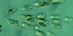 Dinobryon sertularia