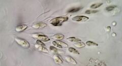 Dinobryon sertularia