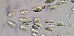 Dinobryon sertularia