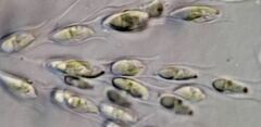 Dinobryon sertularia