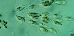 Dinobryon sertularia