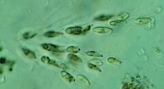 Dinobryon sertularia
