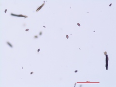 Hypoxylon hypomiltum