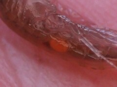Polymorphus